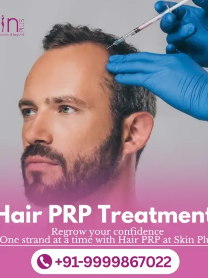 Here you can see the process of a Hair PRP treatment, a non-surgical procedure I use to combat hair thinning. By using the client's own plasma, I can naturally stimulate hair regrowth and improve hair density right at the follicle level.