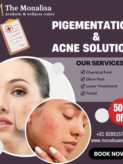 Our pigmentation and acne solution includes expertly applied chemical peels. We offer various peels, including glow peels, to target specific concerns and reveal clearer skin.