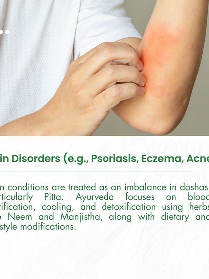 We treat skin disorders like psoriasis and eczema by addressing the root cause, often a Pitta imbalance. Our approach focuses on blood purification and detoxification using herbs like Neem, alongside dietary changes.