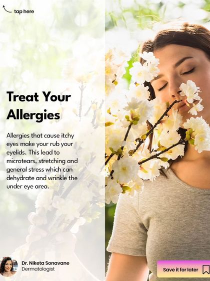 Allergies that cause itchy eyes can lead to microtears, stretching, and wrinkles in the delicate under-eye area. Treating your allergies is an important step in preventing dark circles and maintaining healthy skin around the eyes.