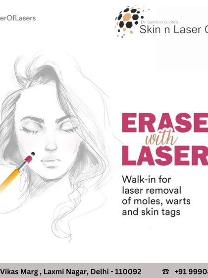 This graphic illustrates the concept of "erasing" unwanted moles, warts, and skin tags with the precision of a laser, offering a walk-in solution for clearer skin.