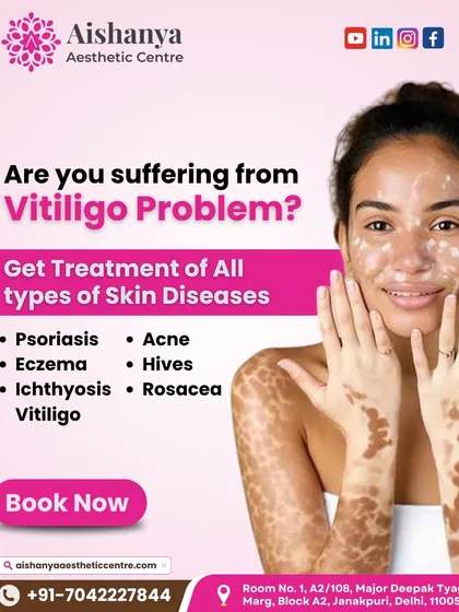 Vitiligo, or "safed daag," requires specialized care. I offer advanced medical and laser-based therapies to help manage the condition and restore pigment, helping you reclaim your even-toned skin and confidence.