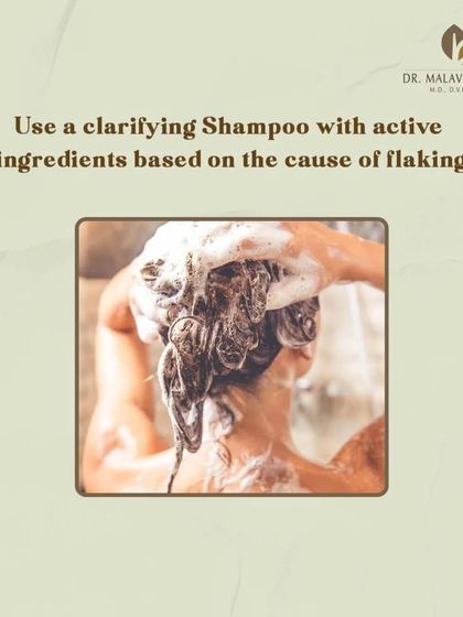 For scalp flaking, I recommend using a clarifying shampoo with active ingredients specifically chosen based on the underlying cause of the flaking, whether it be dryness, oiliness, or a fungal issue.