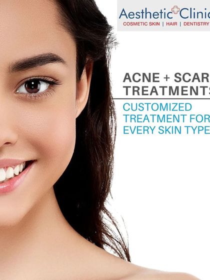 I provide customized treatments for all types of acne and scarring. Using advanced Alma ClearSkin laser technology, I can create a plan that is right for your specific skin type and condition.
