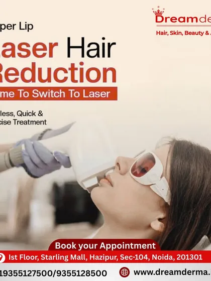 Tired of the constant pain from threading or waxing your upper lip? My laser hair reduction for the face is a precise and quick alternative. The treatment uses a cooling tip to ensure the process is painless, making it a popular choice for sensitive areas.