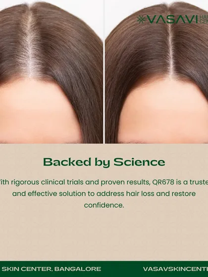 This before-and-after image demonstrates the efficacy of the QR678 treatment for female pattern hair thinning. The treatment works by supplying essential growth factors directly to the scalp, waking up dormant follicles to create a fuller, denser appearance.
