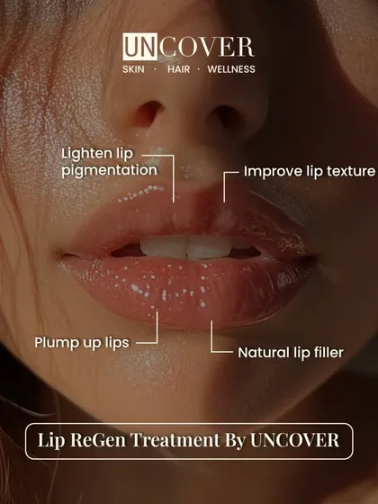 Our Lip ReGen treatment is perfect for anyone wanting to improve lip texture, lighten pigmentation, and get a natural plump. This graphic shows exactly what you can expect, all without needles.