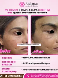 Facial Cosmetic Surgery