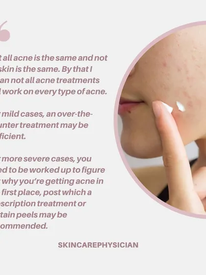 Not all acne treatments work for everyone because every person's skin is different. I create a personalized plan, which may range from over-the-counter products for mild cases to prescriptions for more severe acne.