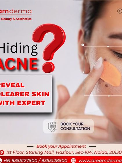 Stop hiding your acne and start healing it. Our expert dermatologists are here to help you reveal clearer, healthier skin with a personalized consultation and treatment strategy.