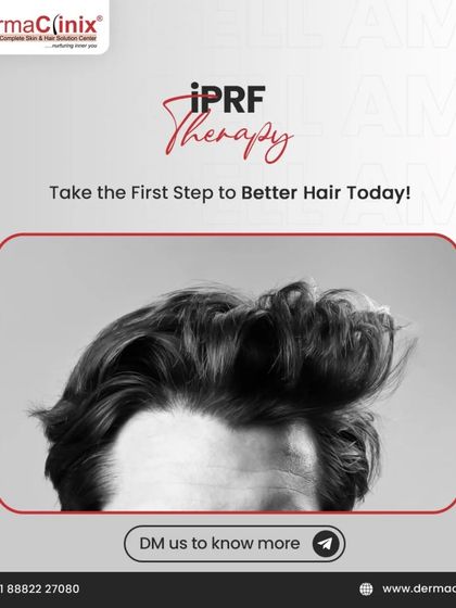 iPRF therapy is your first step to better hair. This treatment offers a natural way to improve hair health and density.