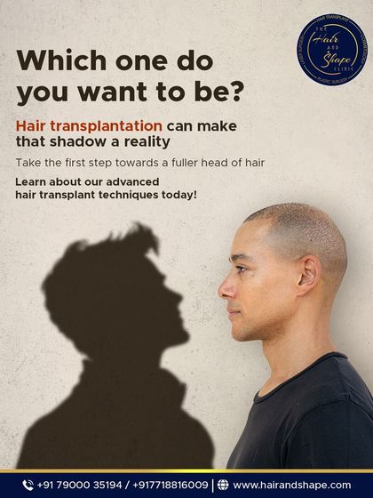 Don't just imagine a fuller head of hair. Our advanced hair transplant techniques can make that shadow a reality.