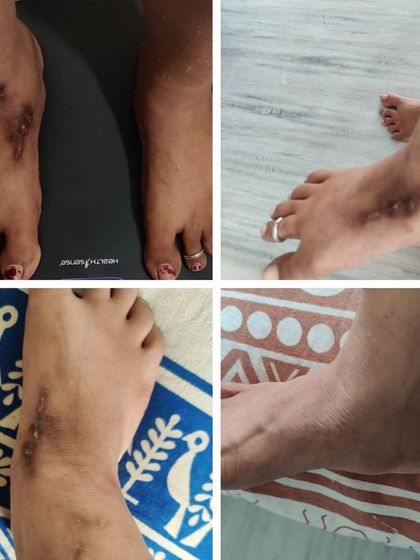 A client shares a lovely message about how a healthy lifestyle helped her get rid of psoriasis. It's not just about weight loss; it's about healing your body from the inside out.