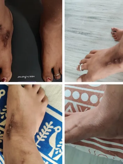 A client shares a lovely message about how a healthy lifestyle helped her get rid of psoriasis. It's not just about weight loss; it's about healing your body from the inside out.
