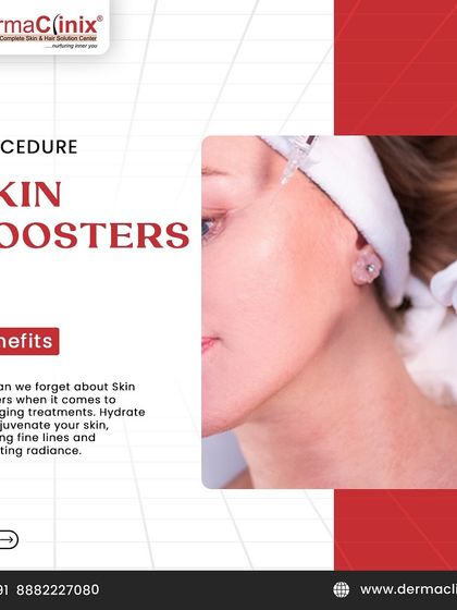 Skin boosters are a key anti-aging treatment. They hydrate and rejuvenate the skin from within, reducing fine lines and promoting a natural radiance.