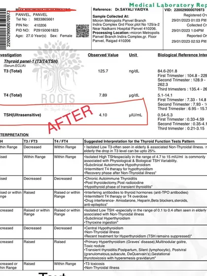 This "after" report for the same patient shows their TSH level reduced to a healthy 4.10 within a month of starting my prescribed Ayurvedic treatment and lifestyle changes.