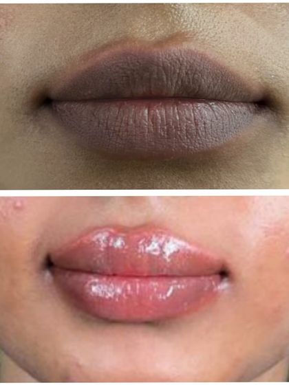 This client had dark pigmentation on her upper lip. The after photo shows how the lip blush treatment corrected the color and gave her a beautiful, glossy, and evenly toned pout.