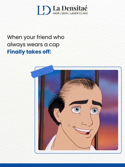 We all have that one friend who always wears a cap. This humorous post is a gentle nudge to let them know they don’t have to hide anymore. With advanced hair restoration, they can bring back their natural look and confidence.