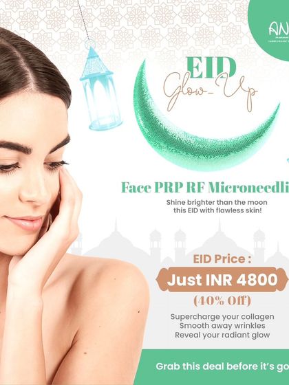 This Eid, shine brighter than the moon with our Face PRP RF Microneedling treatment, available at a special price to help you reveal your radiant glow.