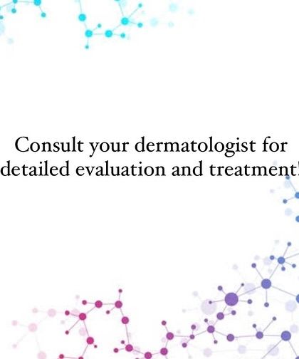 If you are experiencing symptoms of FPHL, a detailed evaluation with a dermatologist is crucial. I can provide a definitive diagnosis and create a personalized treatment plan for you.