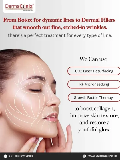 We offer a variety of treatments for every type of line, from Botox for dynamic wrinkles to advanced therapies like CO2 Laser Resurfacing and RF Microneedling that boost collagen and improve overall skin texture.