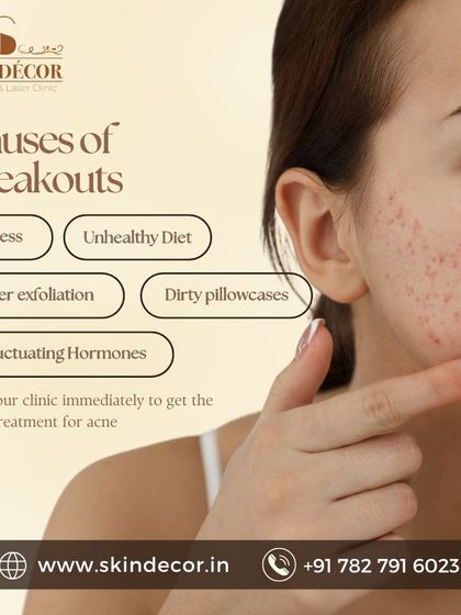 Breakouts can be triggered by a variety of factors. Stress, an unhealthy diet, fluctuating hormones, and even simple things like dirty pillowcases can contribute to acne. Identifying your personal triggers is a big step towards achieving clear skin.