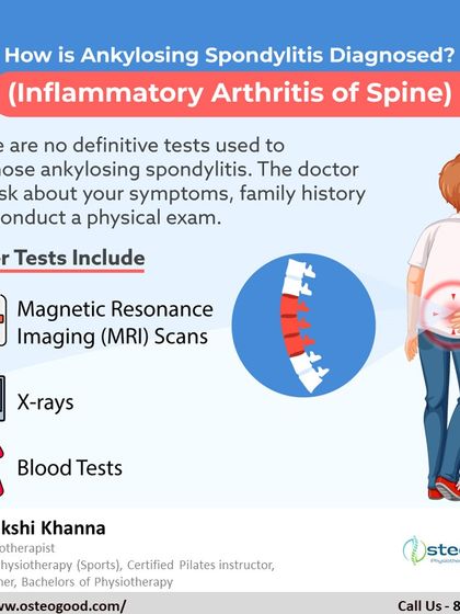 Diagnosing Ankylosing Spondylitis, a type of inflammatory arthritis of the spine, can be complex. It often involves a physical exam, reviewing family history, and may require tests like an MRI or X-rays.