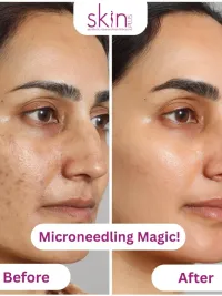 Advanced Skin Correction