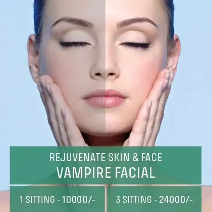 An offer for our Rejuvenate Skin & Face Vampire Facial, with pricing for single and multiple sittings.