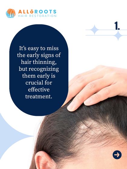 The first step to addressing hair thinning is recognizing the early signs. It's easy to miss them, but being aware allows for timely and effective intervention.