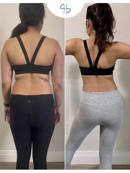 From 56 kg to 51 kg in 6 months. This client focused first on losing stubborn belly fat with home-cooked food, then on gaining muscle with heavy weightlifting.