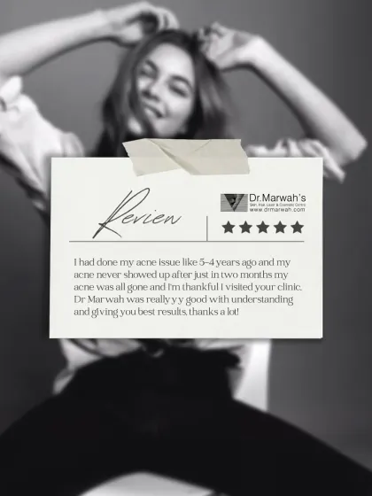 This patient review highlights a 5-year struggle with acne that was resolved within months at our clinic. It is a testament to our focus on understanding the root cause and delivering effective, lasting results.