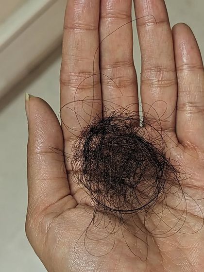 This is another visual representation of about 100 hairs, which is considered a normal amount of daily hair loss for a person with an average head of hair. Understanding this can help you differentiate between normal shedding and excessive hair fall that needs attention.
