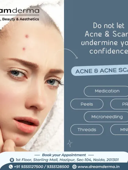 Don't let acne and scars undermine your confidence. We offer a complete toolkit of solutions including medication, peels, PRP, microneedling, threads, and MNRF. Our dermatologists will help you choose the right path for your skin.