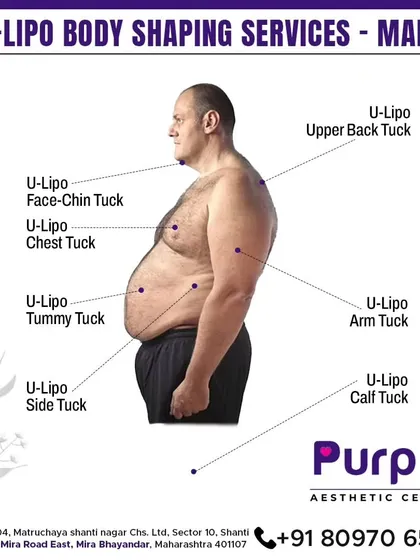 A closer look at the U-Lipo body shaping services available for our male clients. We offer targeted treatments for the face and chin, chest, arms, and tummy for comprehensive body sculpting.