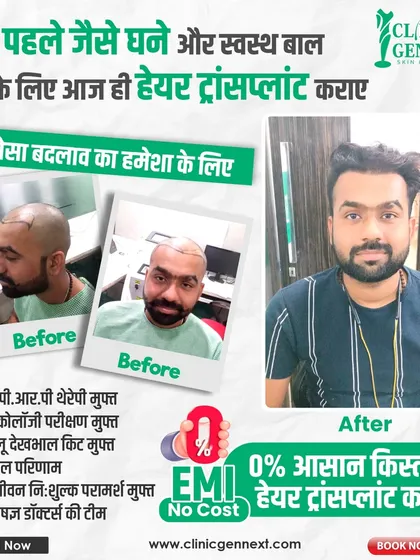 This patient's before-and-after photos show a complete transformation. We offer 0% EMI options to make achieving such results more accessible for everyone.