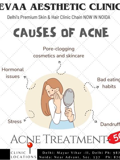 An educational graphic illustrating the common causes of acne, from hormonal issues and stress to pore-clogging cosmetics, highlighting the importance of a holistic approach.