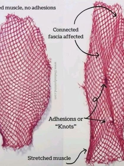 Body & Mind PhysioPilates Studio - Physical Therapy & Rehabilitation Understanding Your Body: Educational Insights photo 20