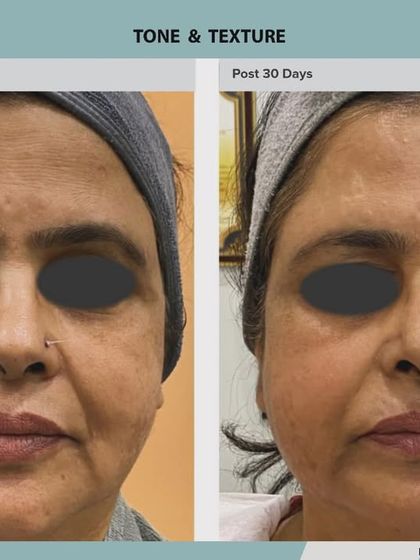 Real Results: Before & After Gallery photo 4