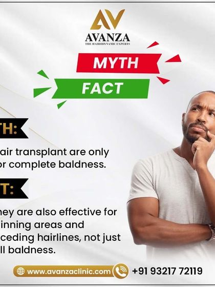 Myth: Hair transplants are only for complete baldness. Fact: They are highly effective for thinning areas and receding hairlines, not just full baldness. We can help at various stages of hair loss.