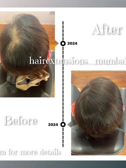 A before and after timeline graphic illustrating the effectiveness of our crown topper. The result is a fuller head of hair that looks completely natural and healthy.