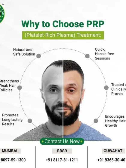 This image illustrates the transformative potential of Platelet-Rich Plasma (PRP) therapy, another powerful non-surgical treatment I offer. It's a natural and clinically proven solution for strengthening weak hair follicles and encouraging healthy growth.