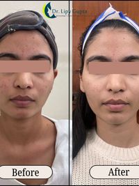 Medical Dermatology Treatments