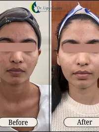 Cosmetic Injectables & Anti-Aging