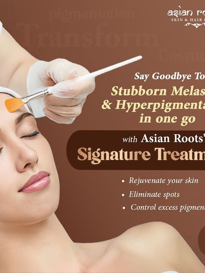 My signature treatment is designed to tackle stubborn melasma and hyperpigmentation in one go. This procedure rejuvenates the skin, eliminates spots, and controls excess pigmentation for a brighter, flawless complexion.