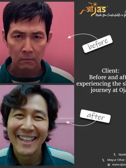 This is the Ojas Skincare effect. We focus on helping you achieve a healthy, natural glow that makes you smile. This before and after perfectly captures the journey from concern to confidence.