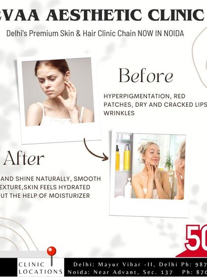 A before-and-after graphic illustrating the transition from skin with hyperpigmentation and dryness to a hydrated, smooth, and glowing complexion post-treatment.