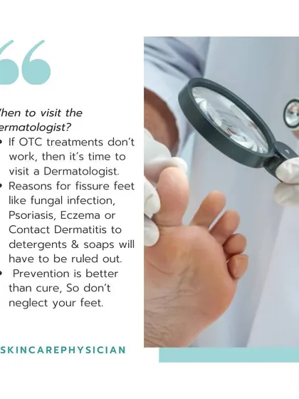 If over-the-counter treatments don't work, it's time to visit a dermatologist. Persistent cracks could be a sign of a fungal infection, psoriasis, or contact dermatitis.