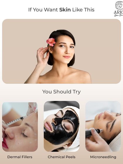 If you want smooth, clear, and glowing skin, you should try treatments like dermal fillers, chemical peels, or microneedling. Each one is designed to address different concerns and can be combined for a complete skin transformation.