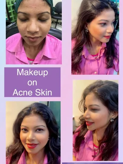 Creating a flawless finish on acne-prone skin is one of our specialties. Here, you can see how we achieved a smooth, even base that looks natural and feels lightweight. We use specific techniques to provide coverage without irritating the skin, helping you feel confident for your event.